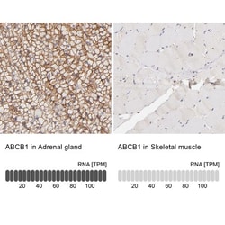 MDR1/ABCB1 Antibody, Novus Biologicals 0.1mL; Unlabeled:Antibodies, Polyclonal